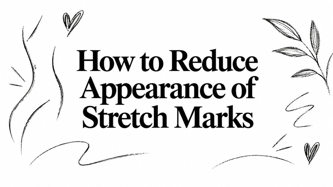 How to Reduce Appearance of Stretch Marks
