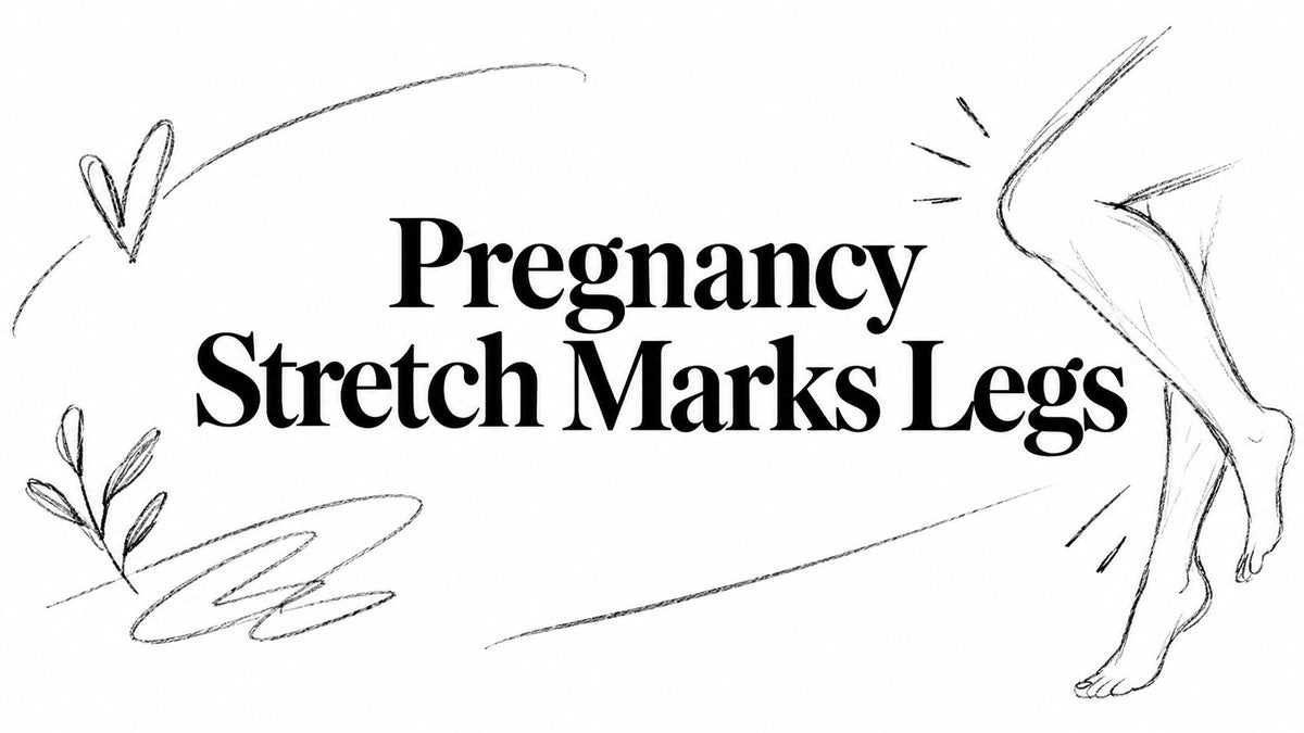 Pregnancy Stretch Marks Legs