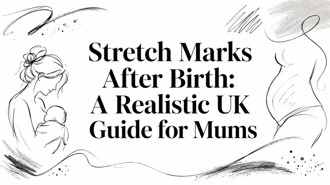 Stretch Marks After Birth: A Realistic UK Guide for Mums