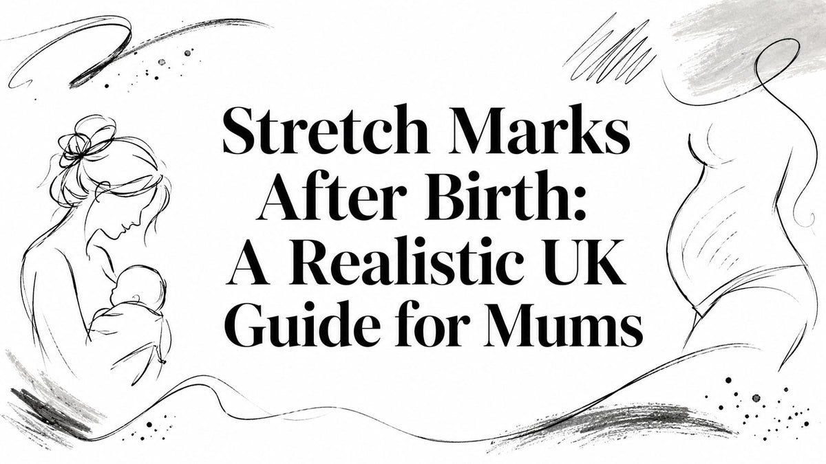 Stretch Marks After Birth: A Realistic UK Guide for Mums