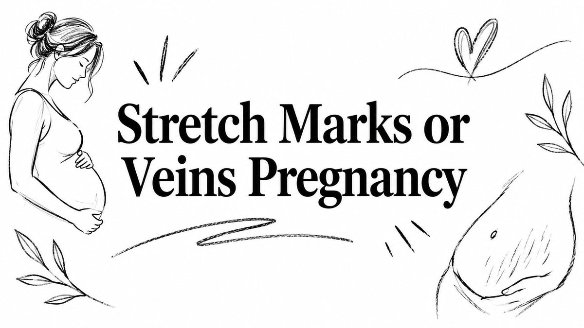 Stretch Marks or Veins Pregnancy