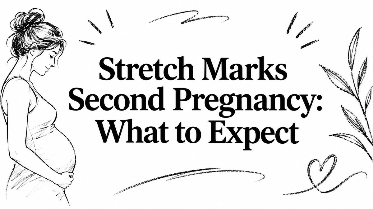Stretch Marks Second Pregnancy: What to Expect