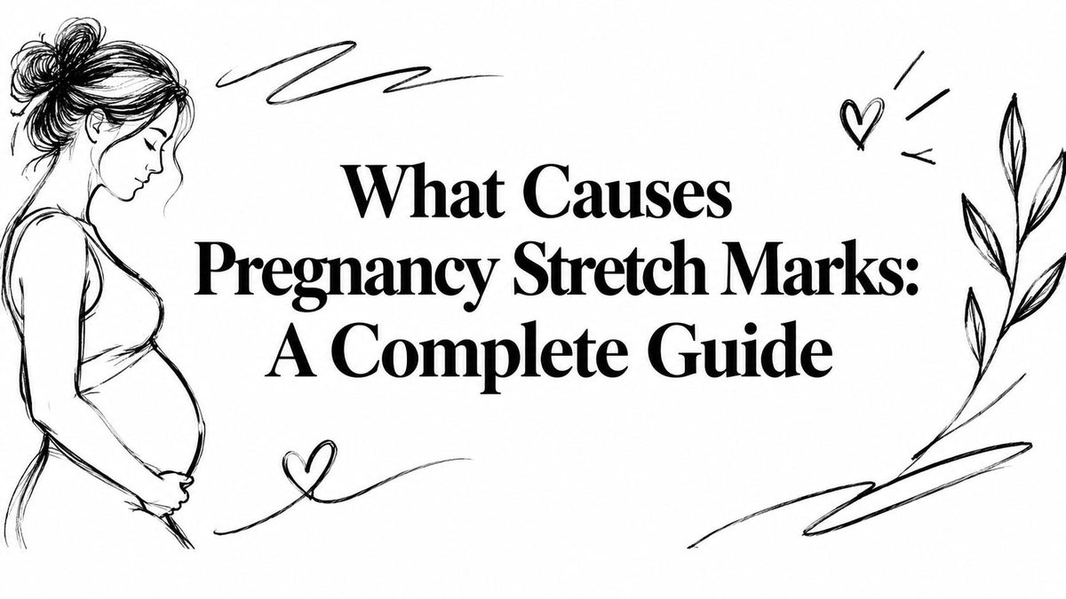 What Causes Pregnancy Stretch Marks: A Complete Guide