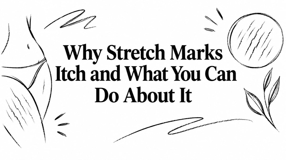 Why Stretch Marks Itch and What You Can Do About It